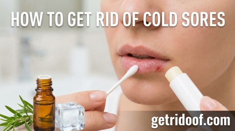 How to Get Rid of Cold Sores