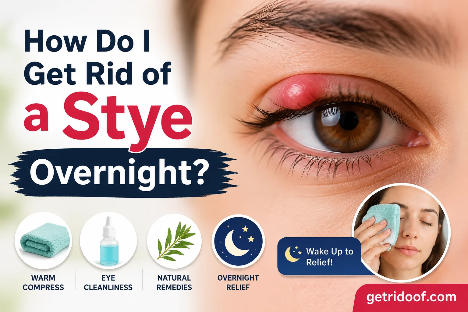 How Do I Get Rid of a Stye Overnight?