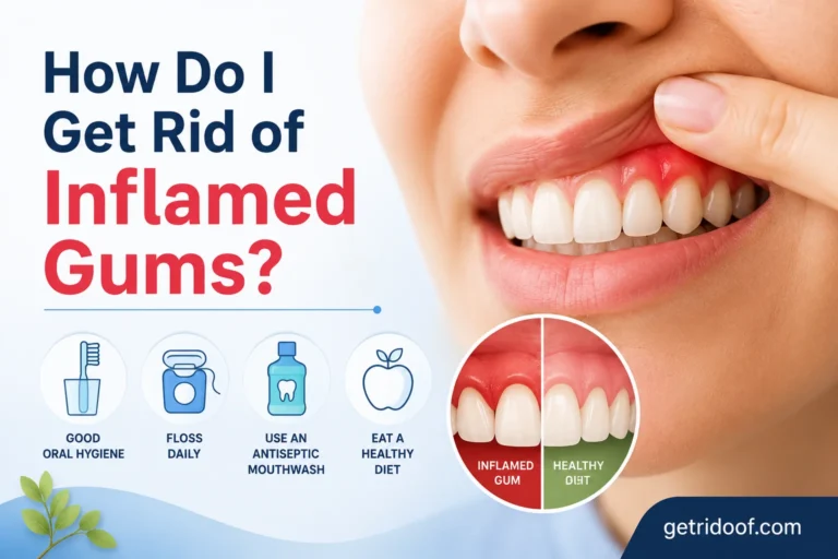 How Do I Get Rid of Inflamed Gums?