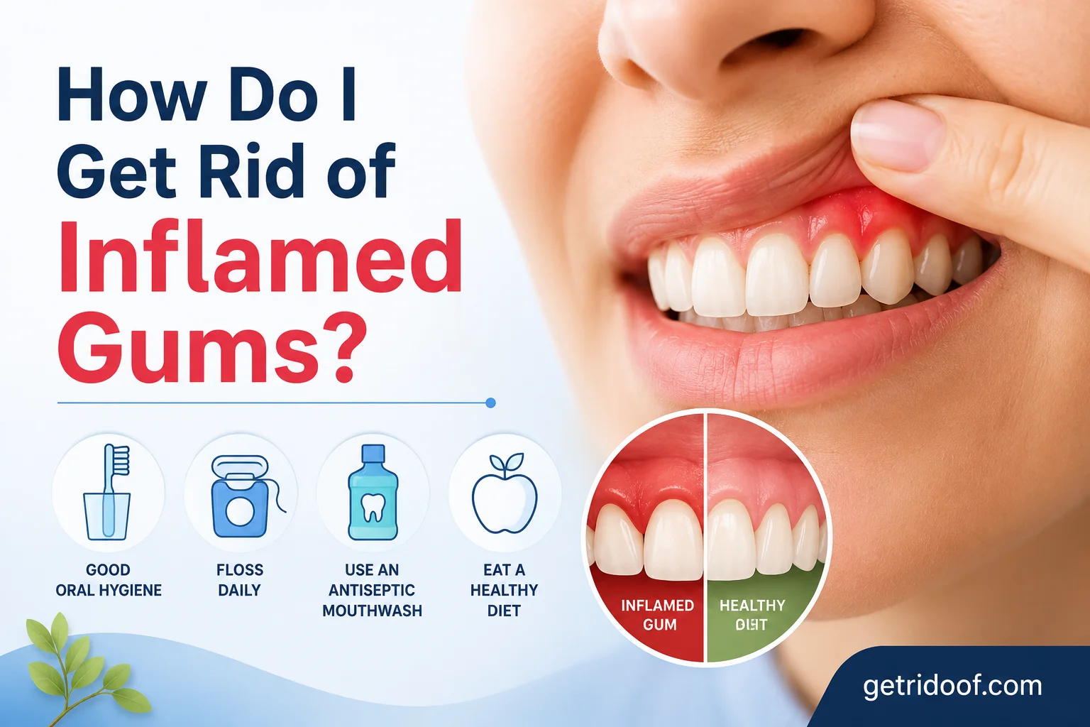 How Do I Get Rid of Inflamed Gums?