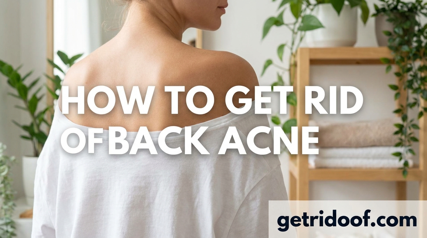 How to Get Rid of Back Acne